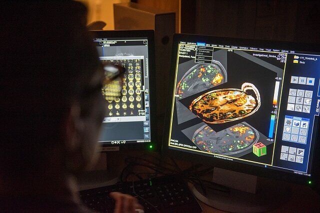 A photograph of the back of a person's head, facing two computer monitor screens, with brain scan imagery on it.