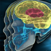 Uncertainty in Brain Tumor Segmentation Challenge