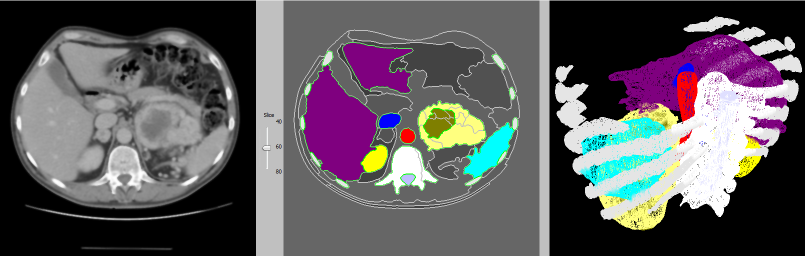 CT scan to 3D reconstruction