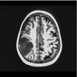 AnoDDPM with Gaussian Noise