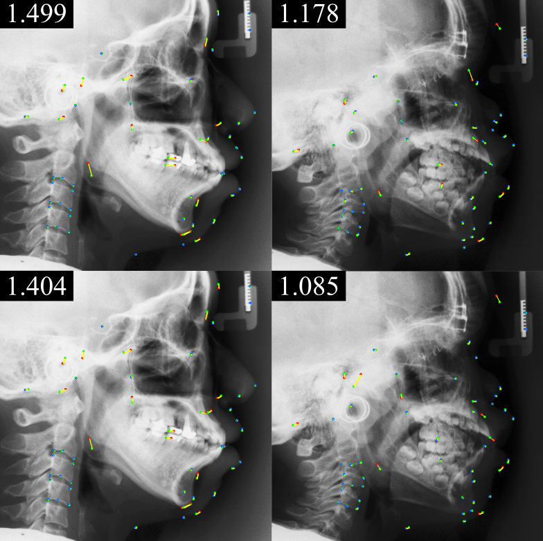 MICCAI 2024 Landmark Detection Challenge qualitative results